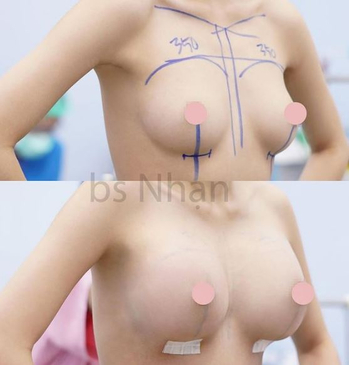 Slider image (2) Dr. Nhan Ho Aesthetics and Plastic Surgery